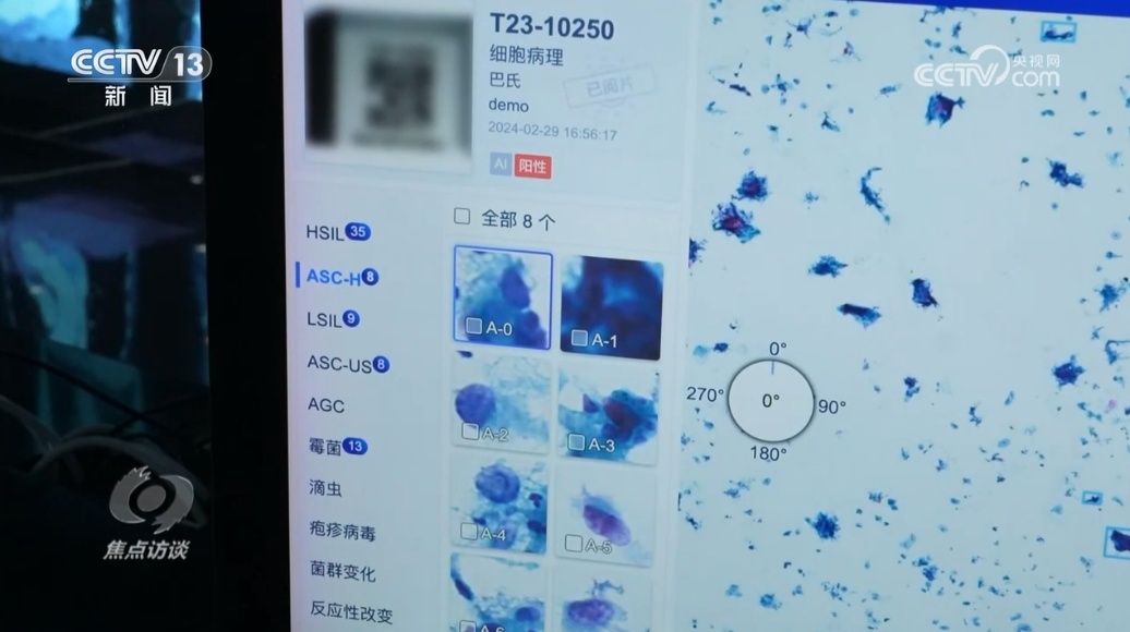 焦点访谈｜更快更准更智能 AI技术正掀起医疗变革泛亚电竞登录(图8)