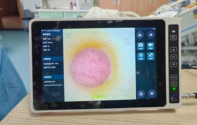 泛亚电竞官网领跑皖北 神经外科重症护理引入“可视化鼻肠管”新技术